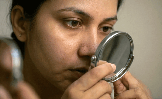 How to Get Rid of Blackheads Naturally at Home